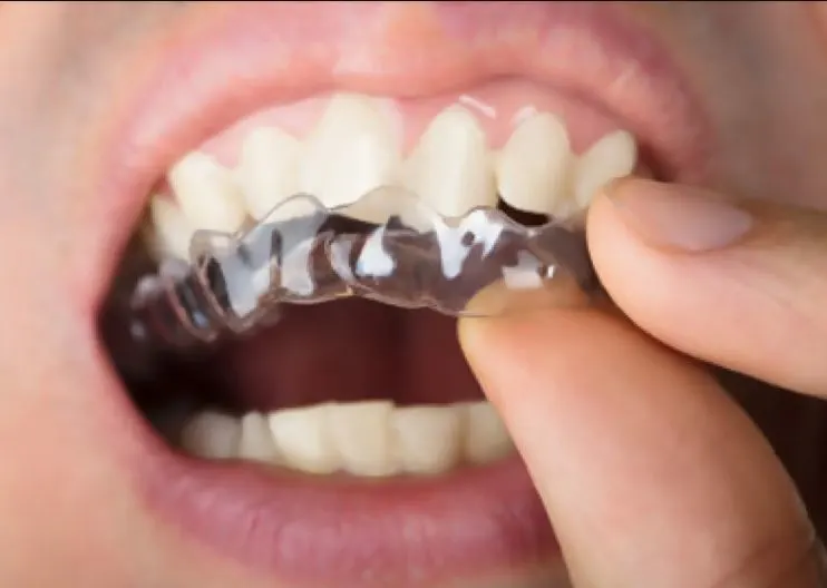 Invisible Teeths